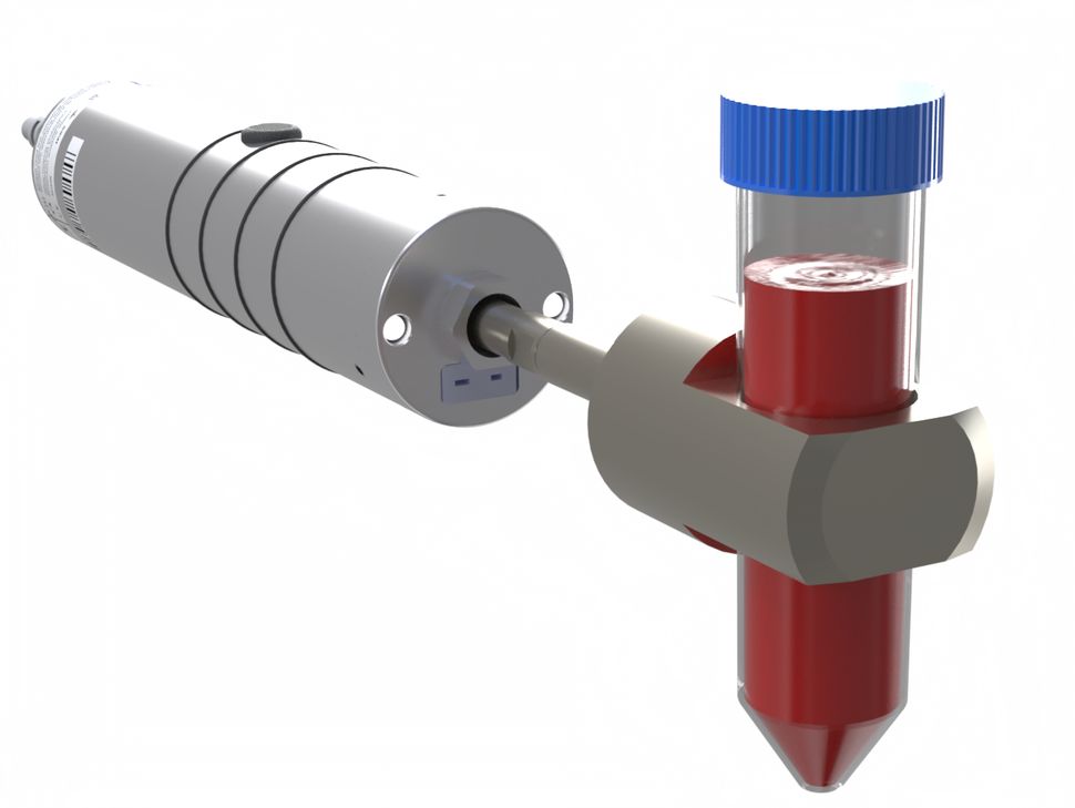 svf kök hücre tedavi